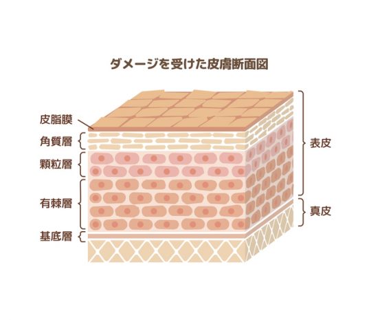 Layer of damaged skin illustration  (japanese)